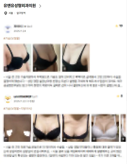 Phòng khám nâng ngực? 2 điều bạn cần biết để không bị các bài review đánh lừa. <Lời khuyên từ 20 năm kinh nghiệm nghiên cứu> — hình ảnh bài viết 2