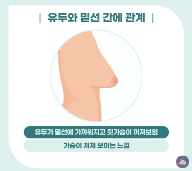Chi phí treo ngực sa trễ là bao nhiêu? Phòng khám thực hiện 3023 ca đặt túi độn ngực chỉ riêng năm ngoái sẽ giải đáp. — hình ảnh bài viết 5