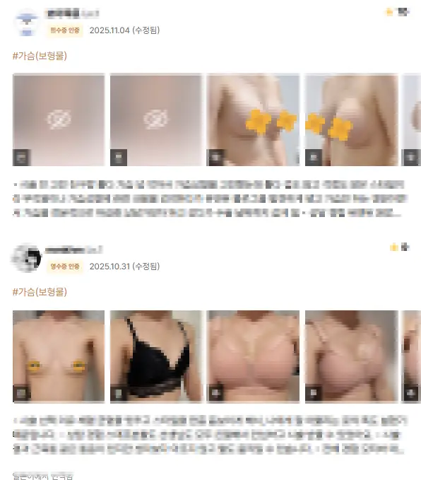 Phòng khám nâng ngực Apgujeong — ngộ nhận rằng chỉ cần xem review về bác sĩ mổ rồi đến là đủ — 본문 이미지