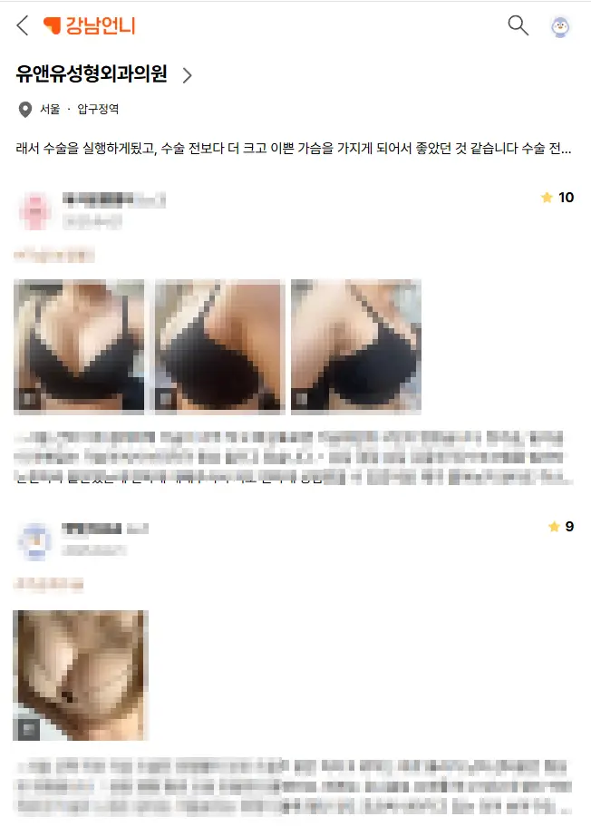 Ngực chảy xệ sau phẫu thuật — đã đặt túi độn rồi, liệu có bị nặng hơn không? — hình ảnh bài viết 2