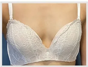 Ảnh trước nâng ngực 4
