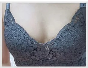 Ảnh trước nâng ngực 5