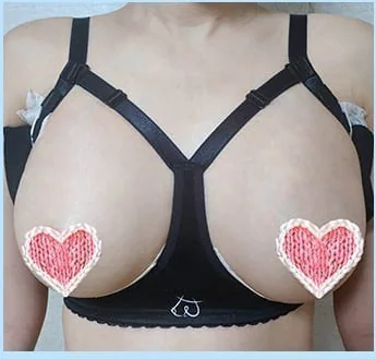 Ngày thứ 2 sau nâng ngực, ảnh chính diện mặc áo định hình 3