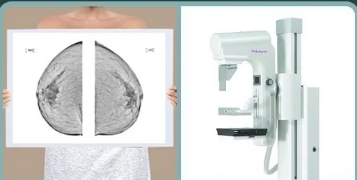 Phim đọc nhũ ảnh và máy chụp nhũ ảnh
