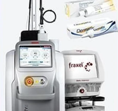 Máy laser trị sẹo và thuốc mỡ trị sẹo