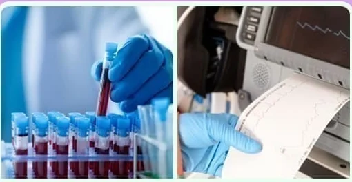 Lấy mẫu máu và giấy ghi điện tim