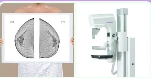 Phim đọc nhũ ảnh và máy chụp nhũ ảnh