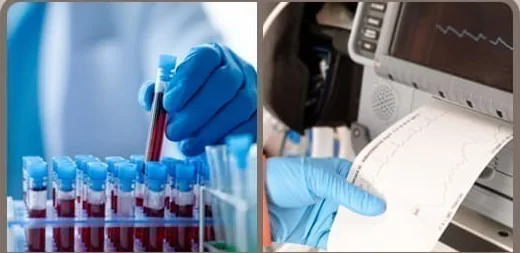 Lấy mẫu máu và giấy ghi điện tim