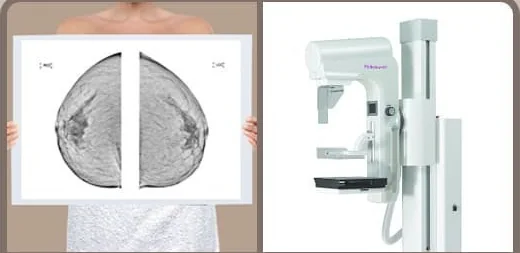 Phim đọc nhũ ảnh và máy chụp nhũ ảnh