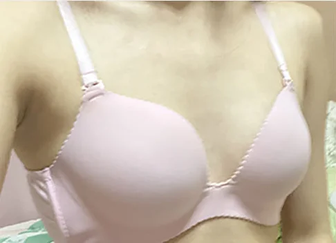 Ảnh trước khi nâng ngực 2