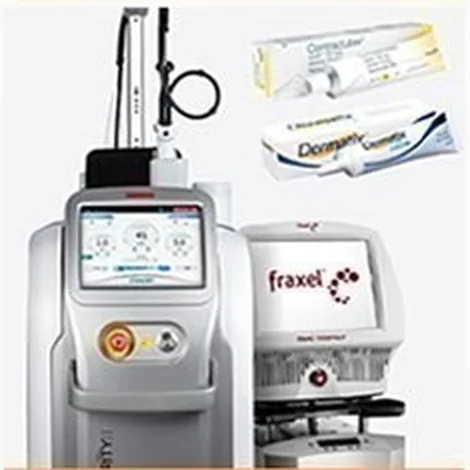 Máy laser trị sẹo và thuốc mỡ trị sẹo