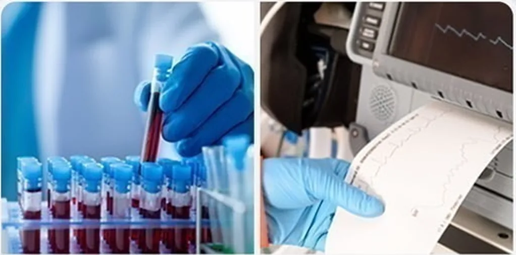 Lấy mẫu máu và giấy ghi điện tim