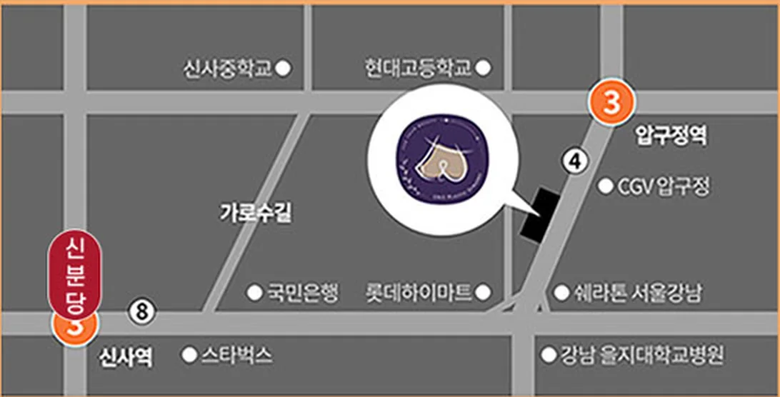 Bản đồ đến Phòng khám Phẫu thuật Thẩm mỹ U&U — gần Garosu-gil, giữa ga Apgujeong (tuyến 3) và ga Sinsa (tuyến Sinbundang)
