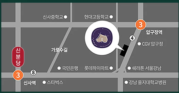 Sơ đồ chỉ đường Phòng khám Phẫu thuật Thẩm mỹ U&U — đi bộ 5 phút từ cửa số 4 ga Apgujeong, gần Garosu-gil