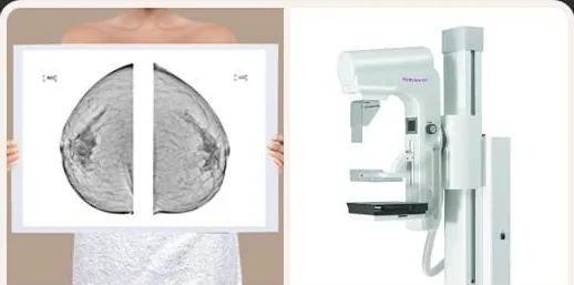 Phim đọc nhũ ảnh và máy chụp nhũ ảnh