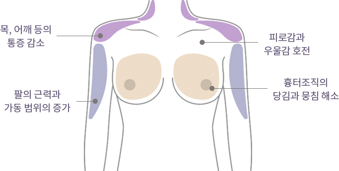Happy Breast Pilates img3 m