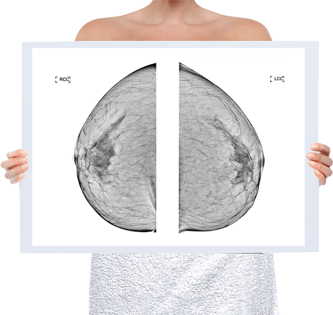 Healthy Breast chụp nhũ ảnh img5 m