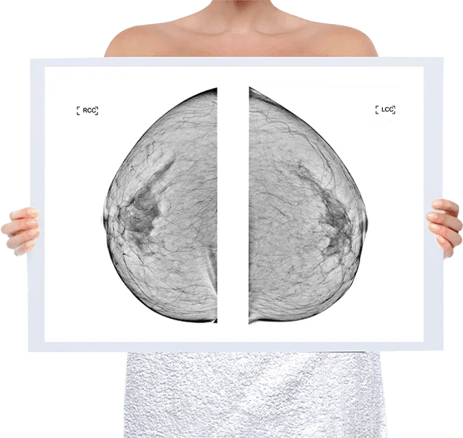 Healthy Breast chụp nhũ ảnh img5 m
